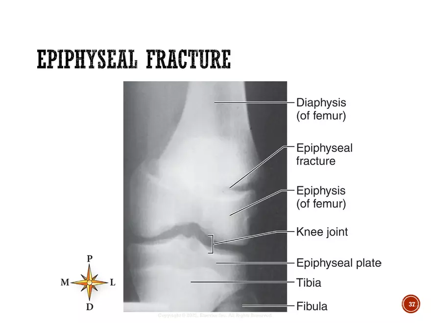 Ch. 11, 12, 13 Skeletal Tissues, Axial and Appendicular Skeleton-3 - Page 31