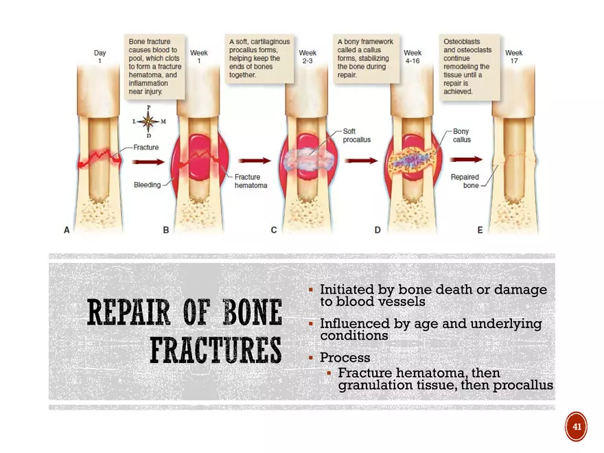 Ch. 11, 12, 13 Skeletal Tissues, Axial and Appendicular Skeleton-3 - Page 36