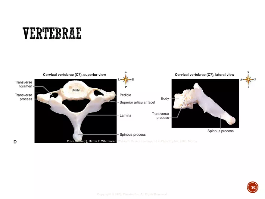 Ch. 11, 12, 13 Skeletal Tissues, Axial and Appendicular Skeleton-3 - Page 67
