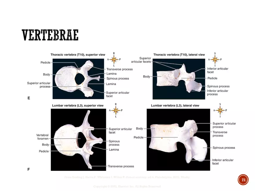 Ch. 11, 12, 13 Skeletal Tissues, Axial and Appendicular Skeleton-3 - Page 69