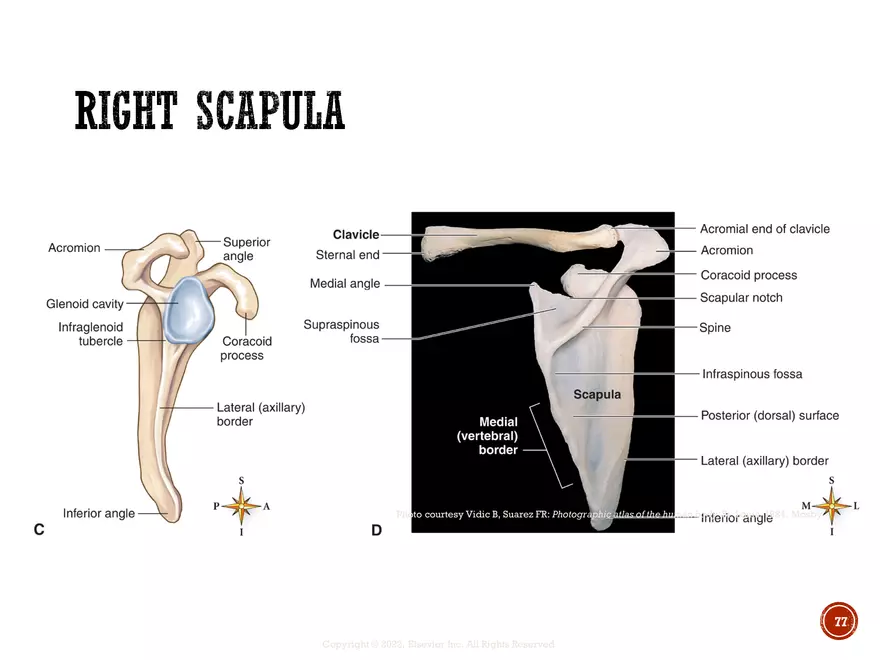Ch. 11, 12, 13 Skeletal Tissues, Axial and Appendicular Skeleton-3 - Page 75