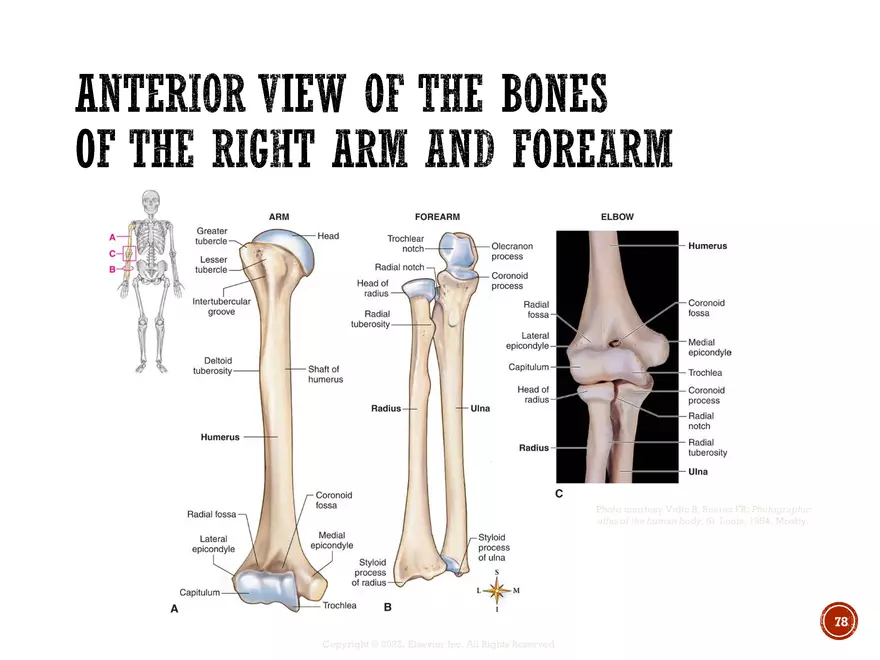 Ch. 11, 12, 13 Skeletal Tissues, Axial and Appendicular Skeleton-3 - Page 76
