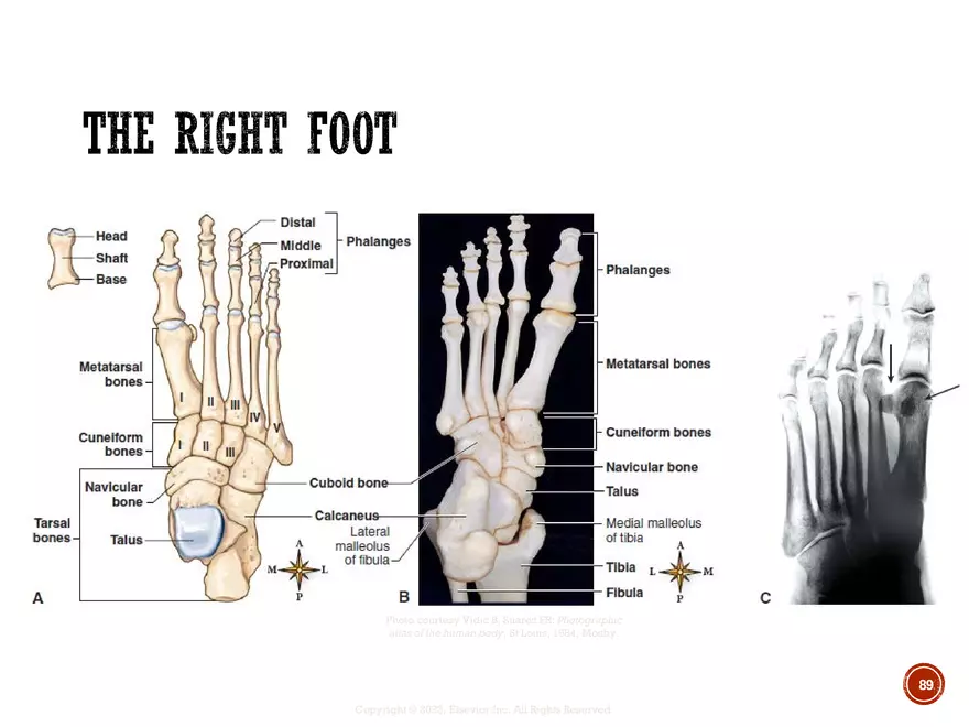 Ch. 11, 12, 13 Skeletal Tissues, Axial and Appendicular Skeleton-3 - Page 88