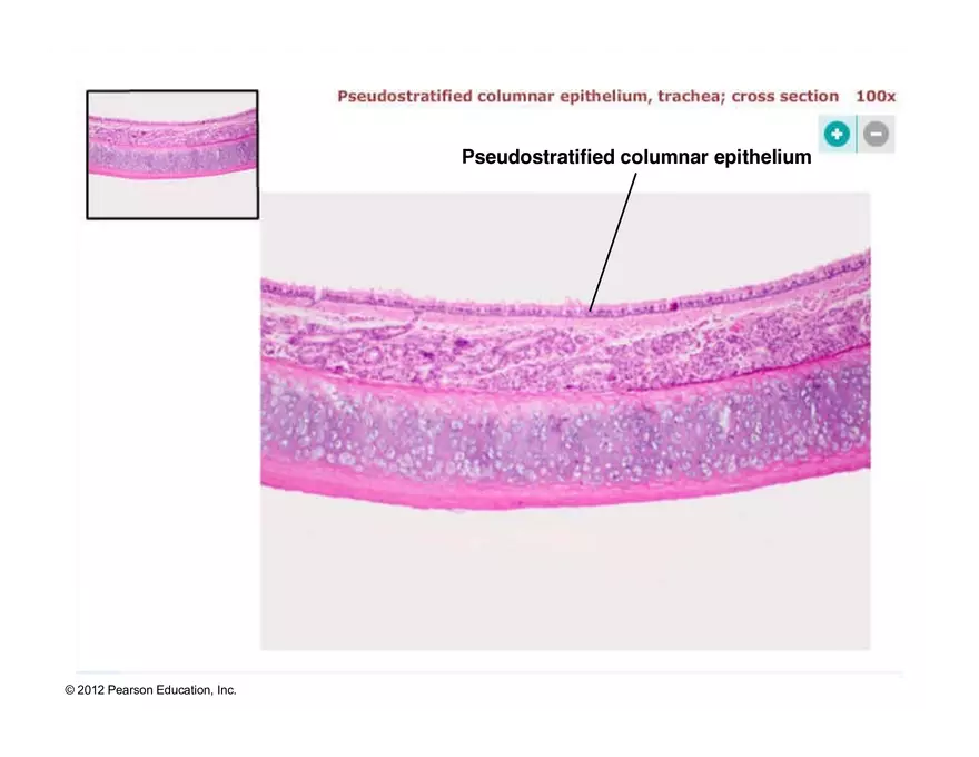 Exercise #6 Classification of Tissues - Epithelial Tissue - Page 36