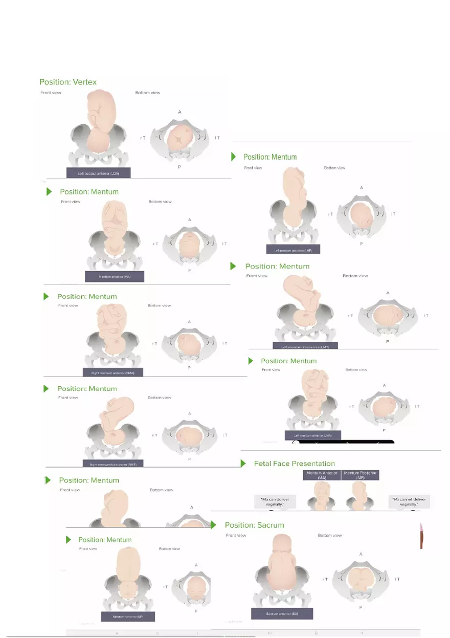 5 P's of Labor - Page 5