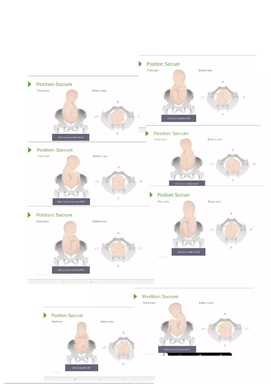 5 P's of Labor - Page 6