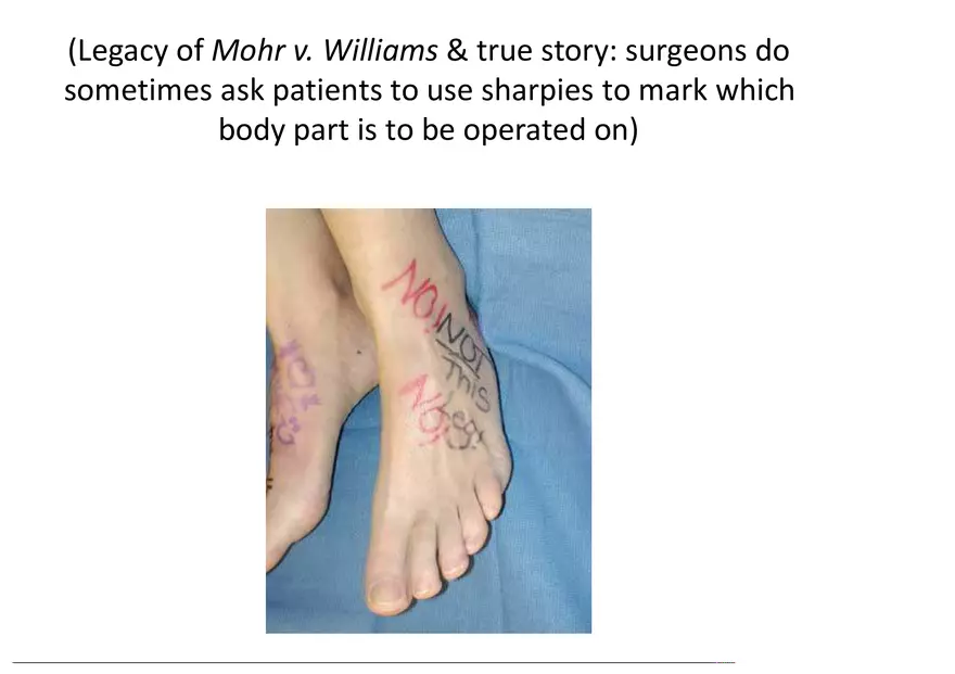 What is a Tort (Lecture) Part 5 - Page 10