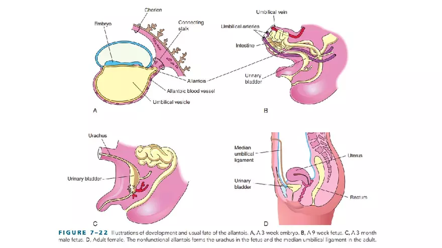 Placenta, Extraembryonic Membranes, and Multiple Pregnancies Part 6 - Page 11
