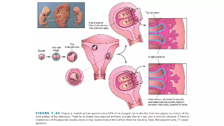 Placenta, Extraembryonic Membranes, and Multiple Pregnancies Part 6 - Page 3