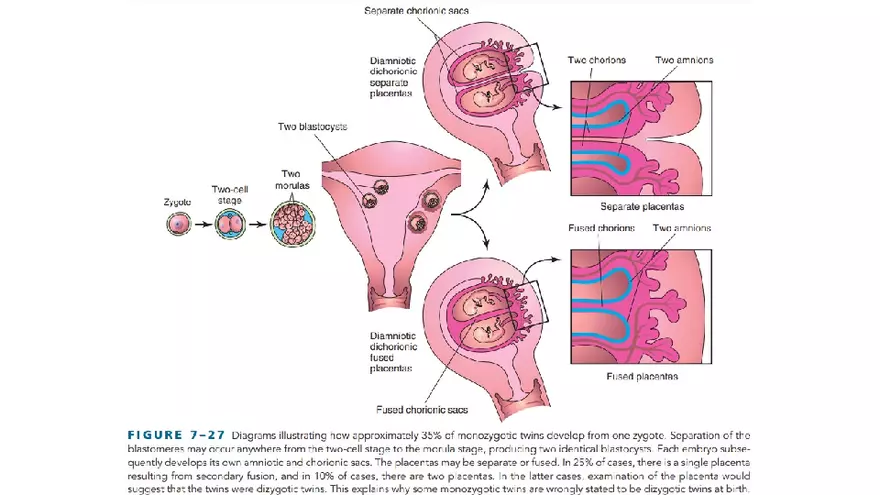 Placenta, Extraembryonic Membranes, and Multiple Pregnancies Part 6 - Page 4