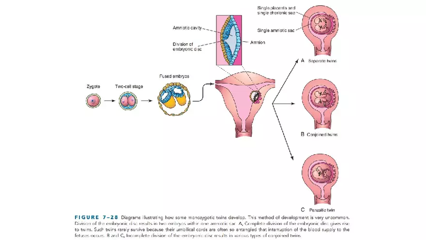 Placenta, Extraembryonic Membranes, and Multiple Pregnancies Part 6 - Page 5