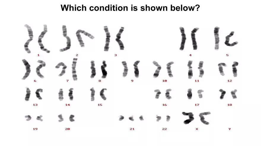 Alterations in Chromosome Number or Structure - Page 16