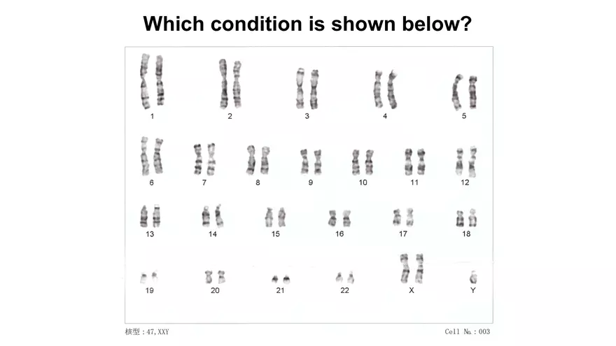 Alterations in Chromosome Number or Structure - Page 17