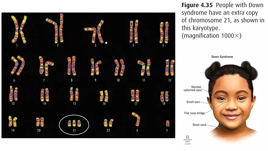 Alterations in Chromosome Number or Structure - Page 22