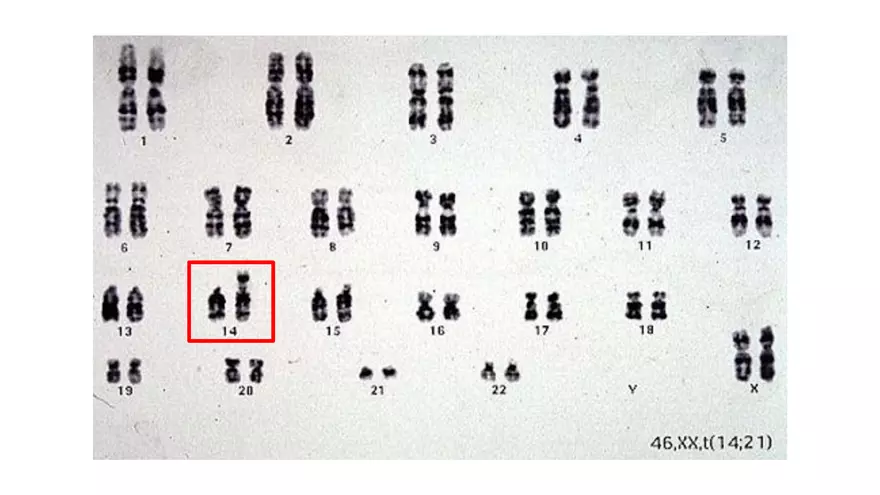 Alterations in Chromosome Number or Structure - Page 6