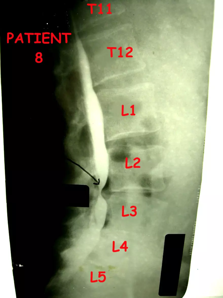 X-Ray Web Lab - Page 8