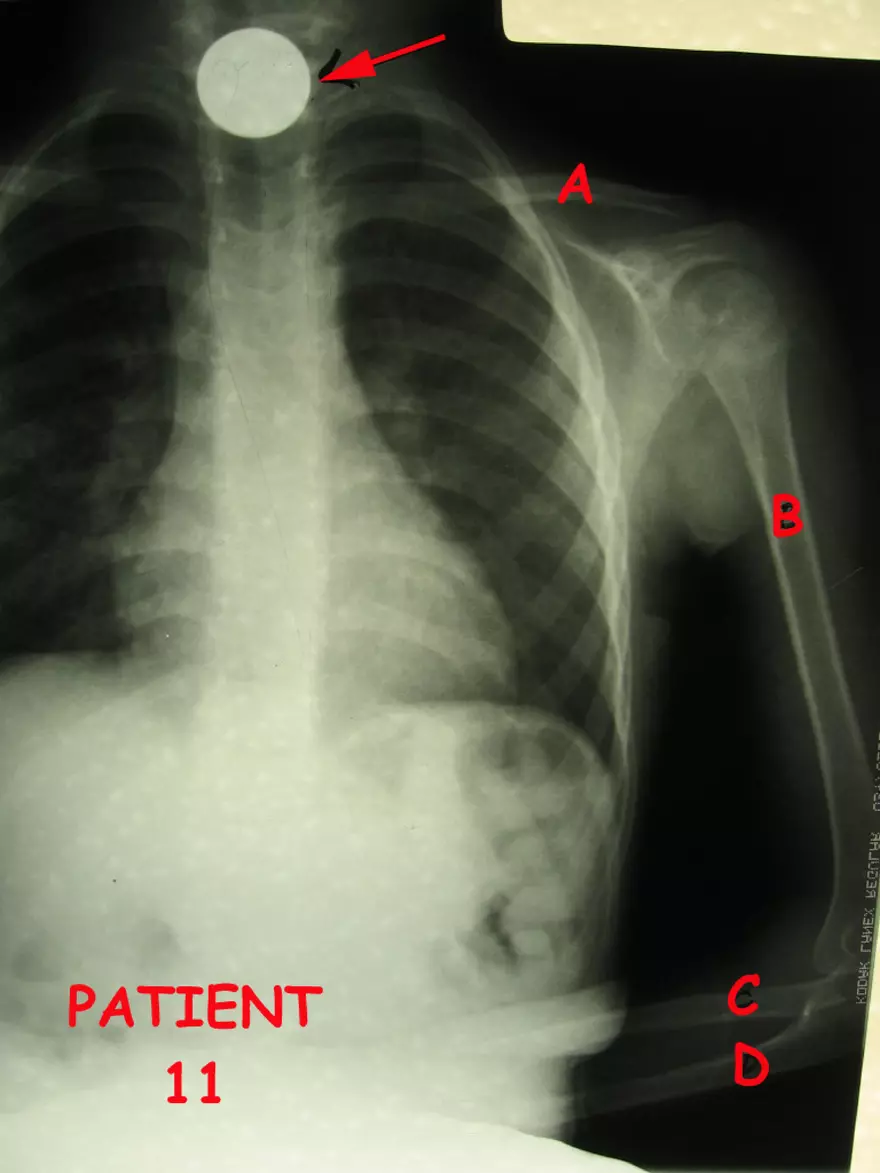 X-Ray Web Lab - Page 15