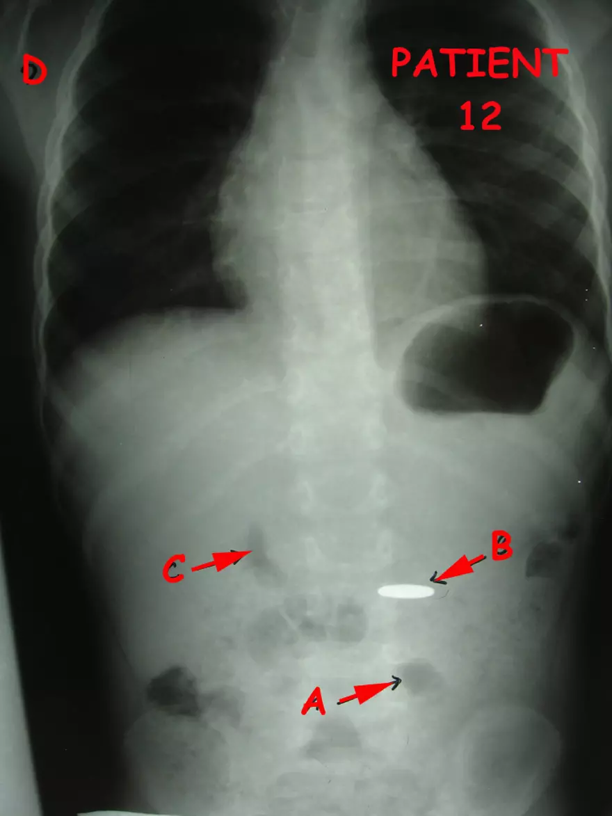 X-Ray Web Lab - Page 17