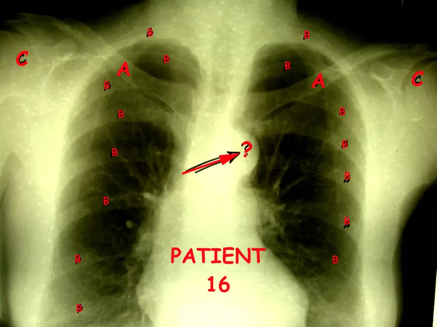 X-Ray Web Lab - Page 26