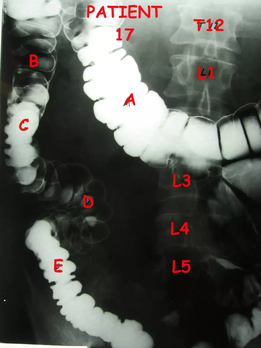 X-Ray Web Lab - Page 28