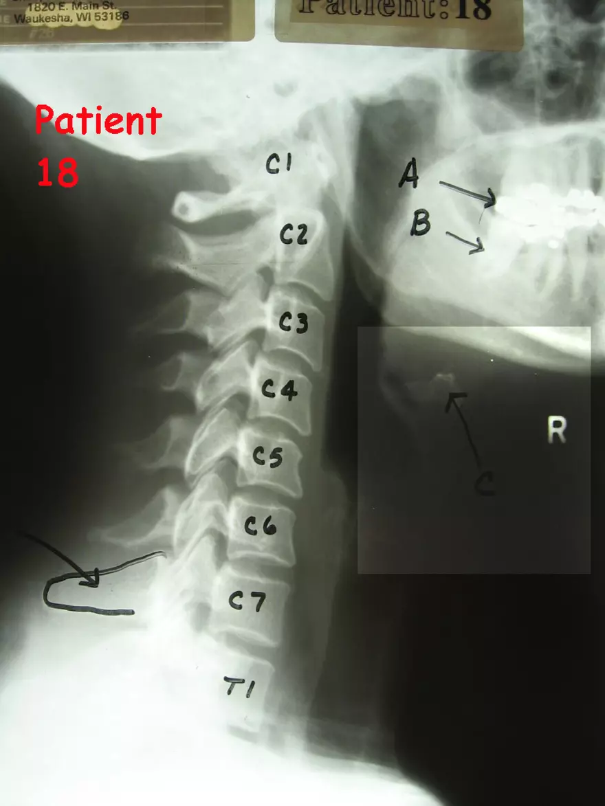 X-Ray Web Lab - Page 30