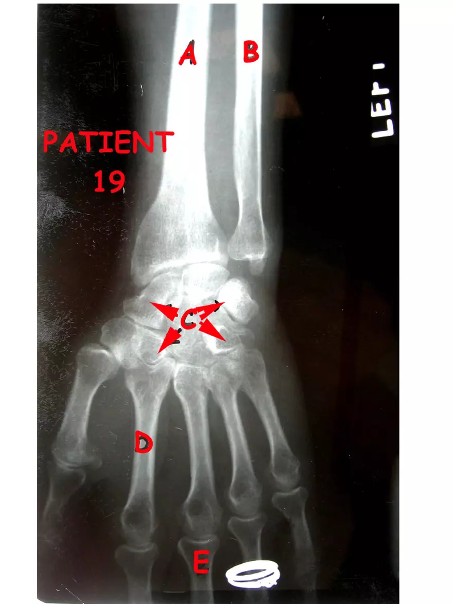 X-Ray Web Lab - Page 32