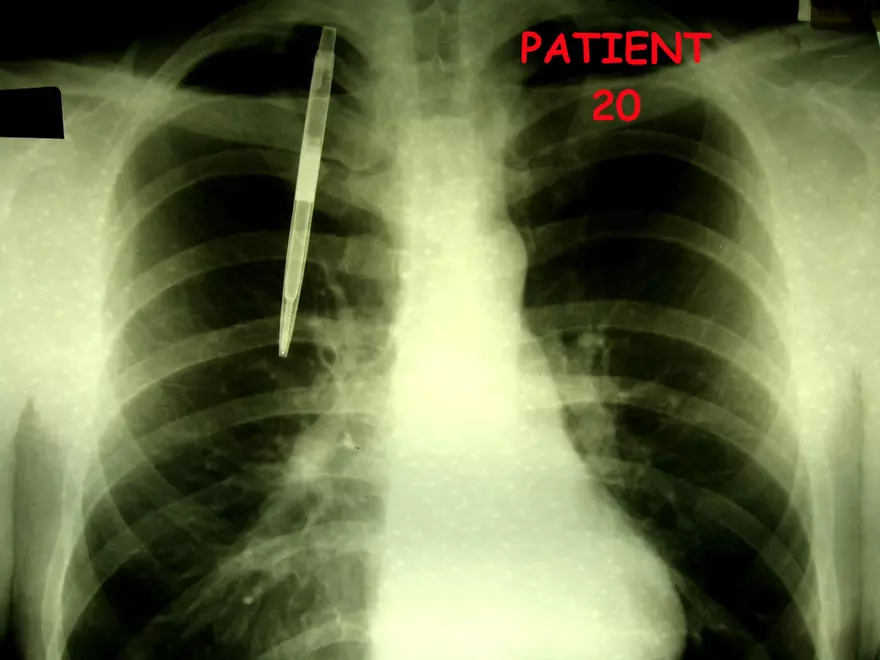 X-Ray Web Lab - Page 34