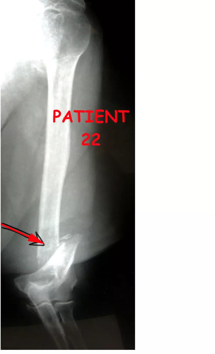 X-Ray Web Lab - Page 39