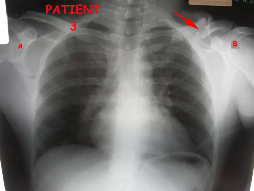 X-Ray Web Lab - Page 46