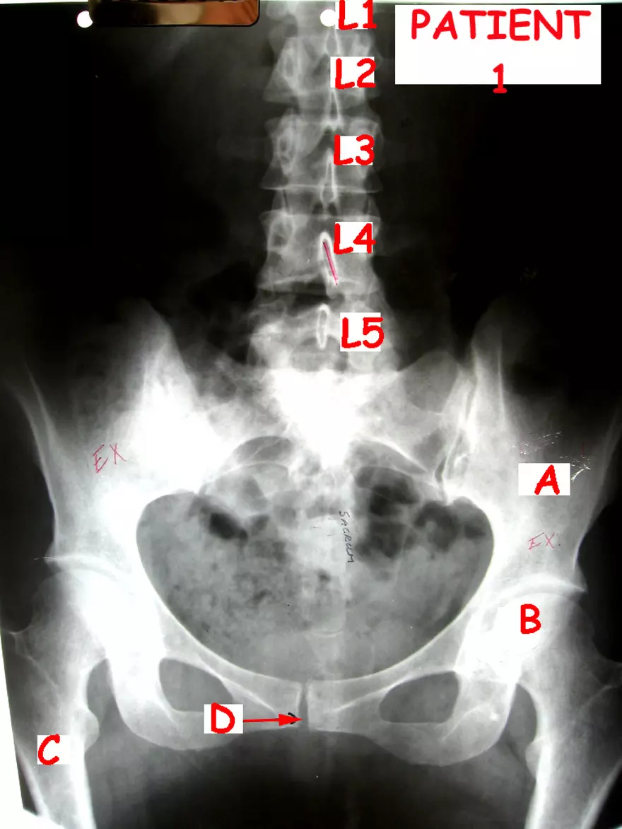 X-Ray Web Lab - Page 2