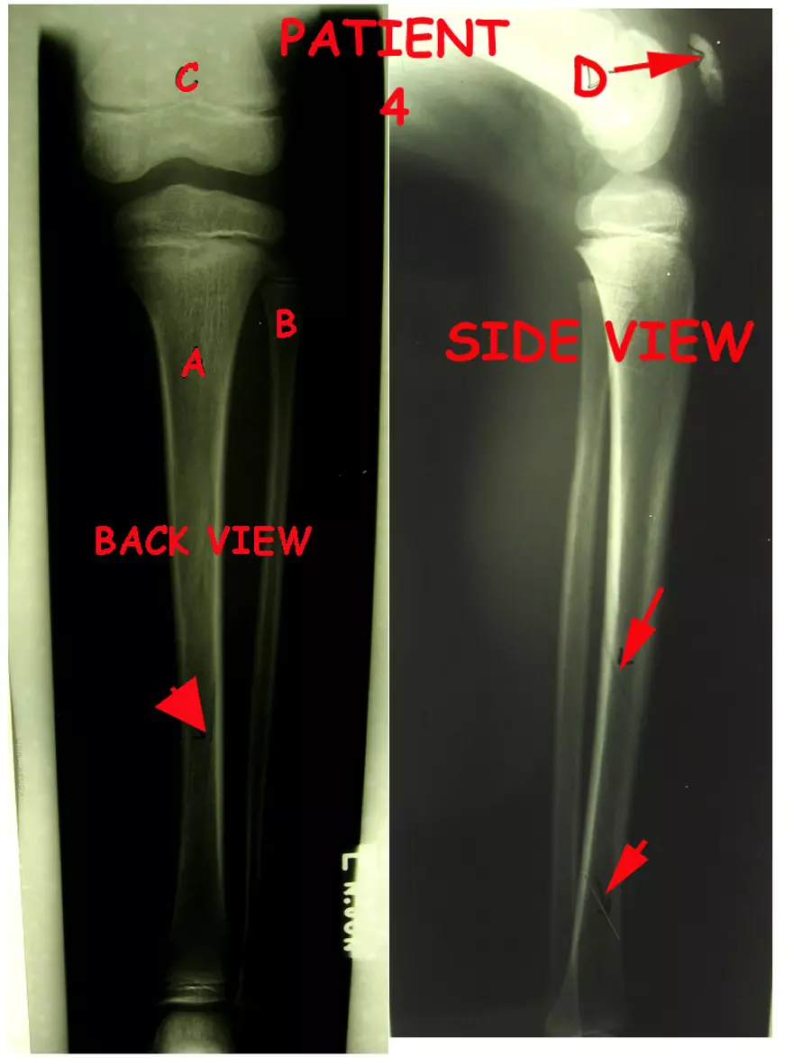 X-Ray Web Lab - Page 52