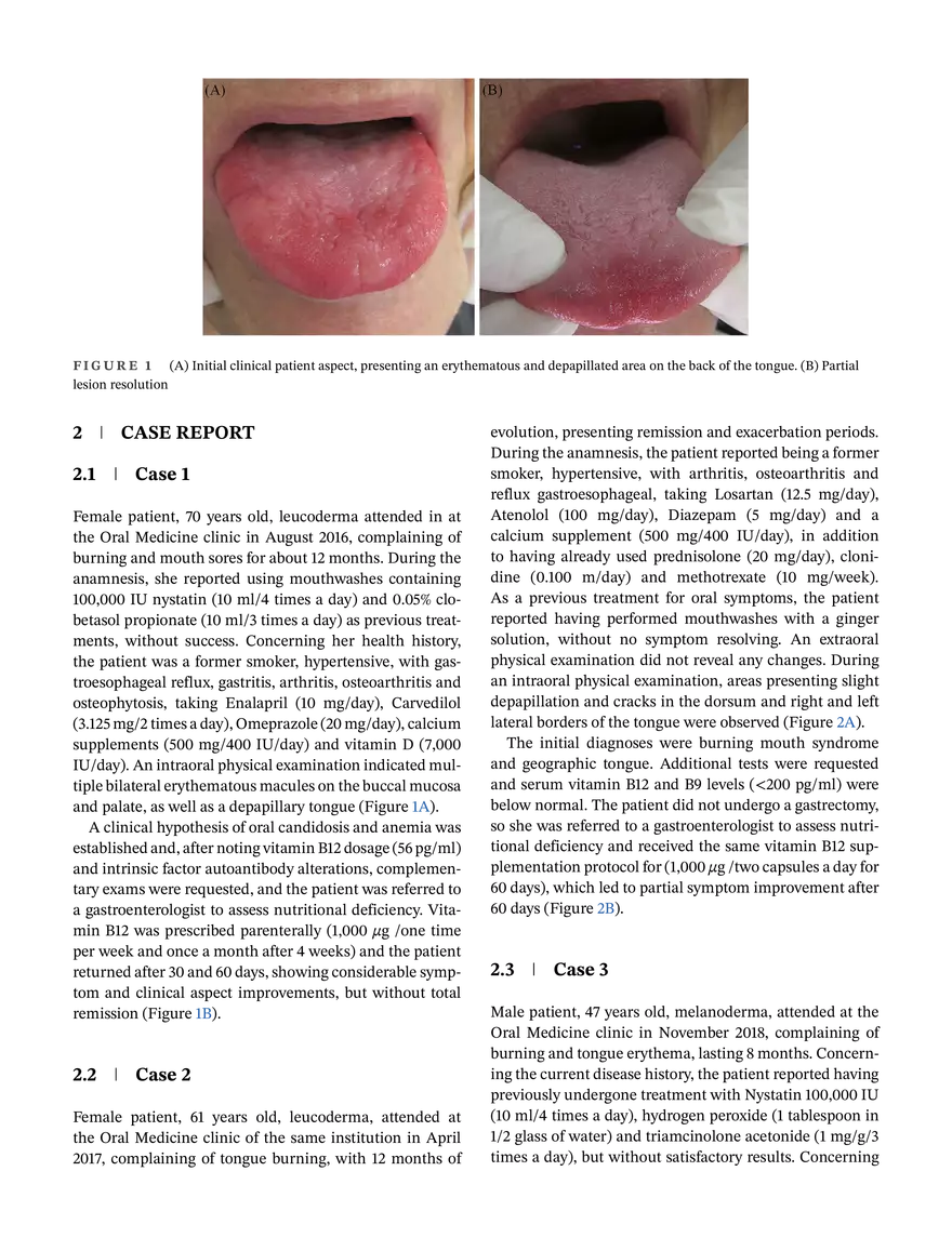 Report of Four Cases With Oral Manifestations - Page 2