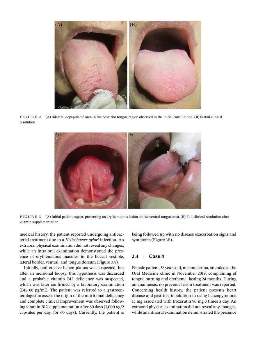 Report of Four Cases With Oral Manifestations - Page 3
