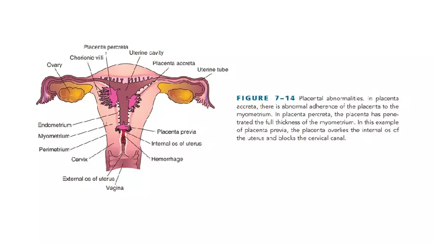 Placenta, Extraembryonic Membranes, and Multiple Pregnancies Part 5 - Page 10