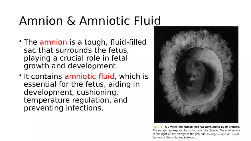 Placenta, Extraembryonic Membranes, and Multiple Pregnancies Part 5 - Page 12