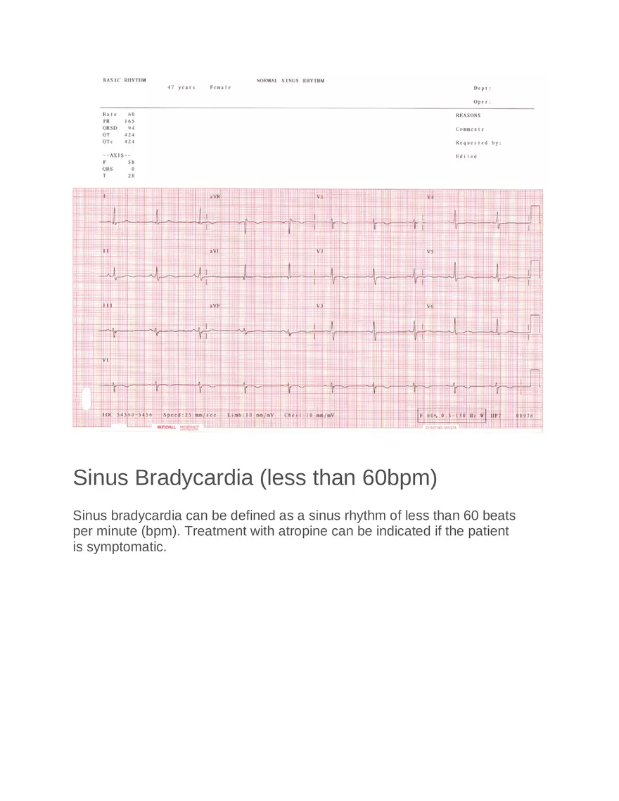 Intro to Cardiology Module 1 Guide Part 7 - Page 8