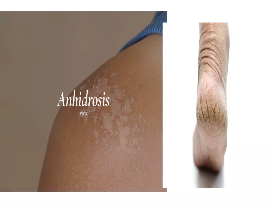 The Integumentary System Lecture (Skin) - Page 9