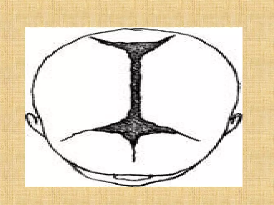 Profile of the Newborn Lecture Part 2 - Page 9