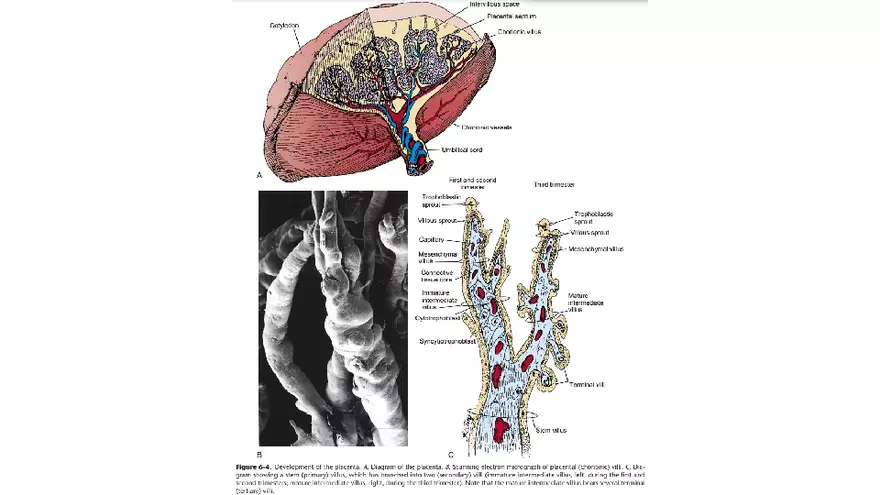 Placenta, Extraembryonic Membranes, and Multiple Pregnancies Part 2 - Page 7