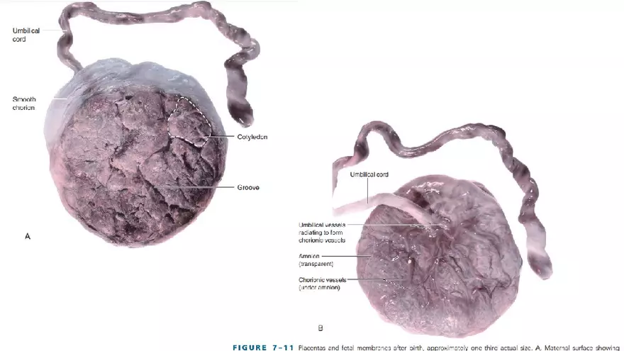 Placenta, Extraembryonic Membranes, and Multiple Pregnancies Part 2 - Page 3
