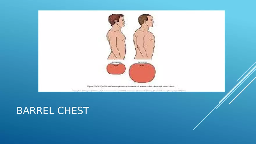 Chronic Obstructive Pulmonary Disease (COPD) Part 2 - Page 4