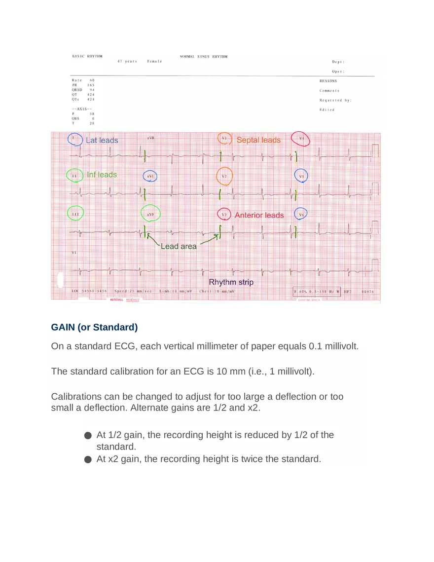 Intro to Cardiology Module 1 Guide Part 6 - Page 5