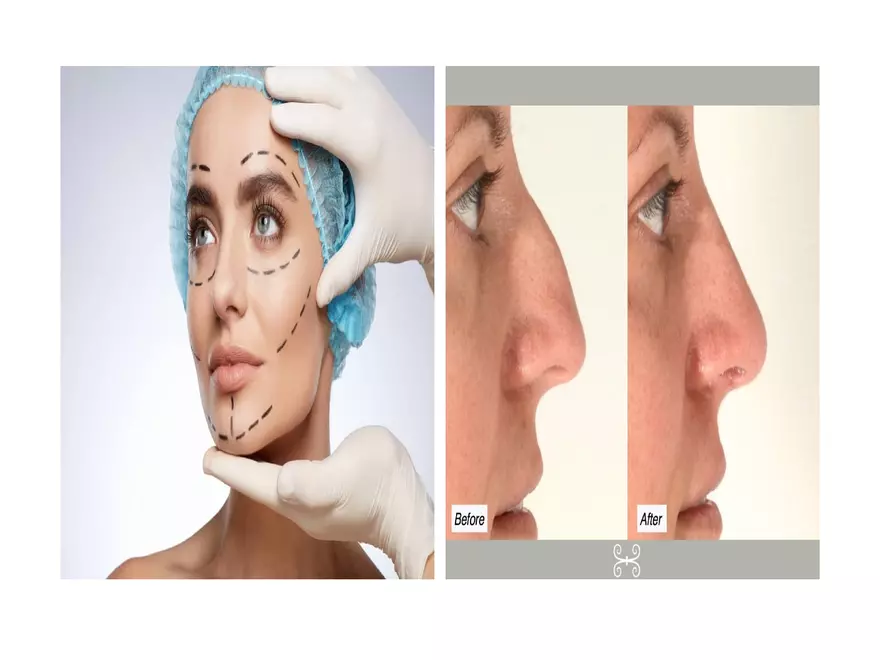 The Integumentary System Lecture (Hair) - Page 8