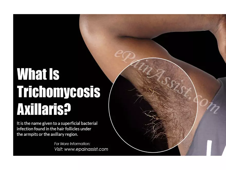 The Integumentary System Lecture (Hair) - Page 10