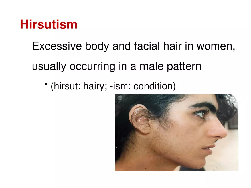 The Integumentary System Lecture (Hair) - Page 11