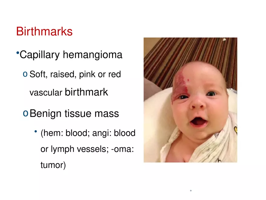 The Integumentary System Lecture (Hair) - Page 13