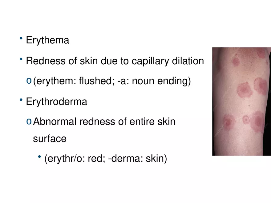 The Integumentary System Lecture (Hair) - Page 14