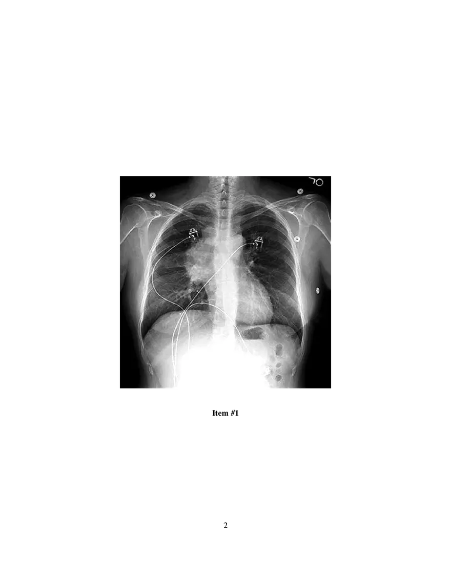 Superior Vena Cava Syndrome in a Patient with Non-Hodgkin Lymphoma - Page 2