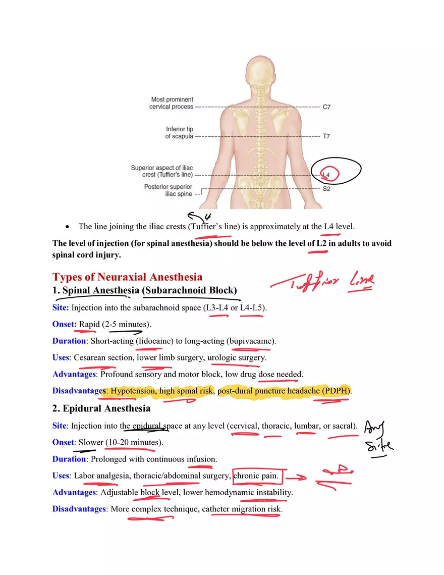 Neuraxial Anesthesia - Page 2