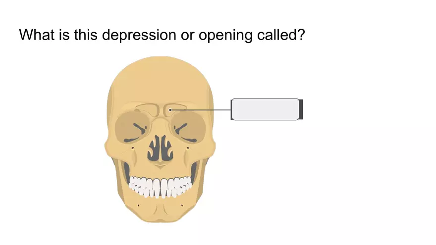 Bone Project Presentation - Page 8